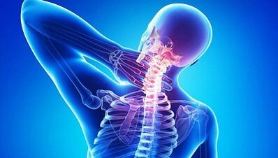 Jak objawia się osteochondroza