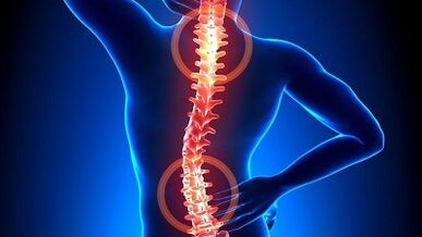 mechanizm rozwoju osteochondrozy