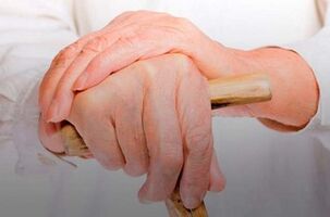 ból stawów palców z reumatoidalnym zapaleniem stawów