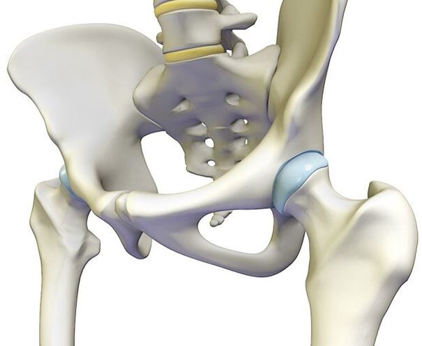 Osteochondroza wywołuje ostry ból w stawie biodrowym